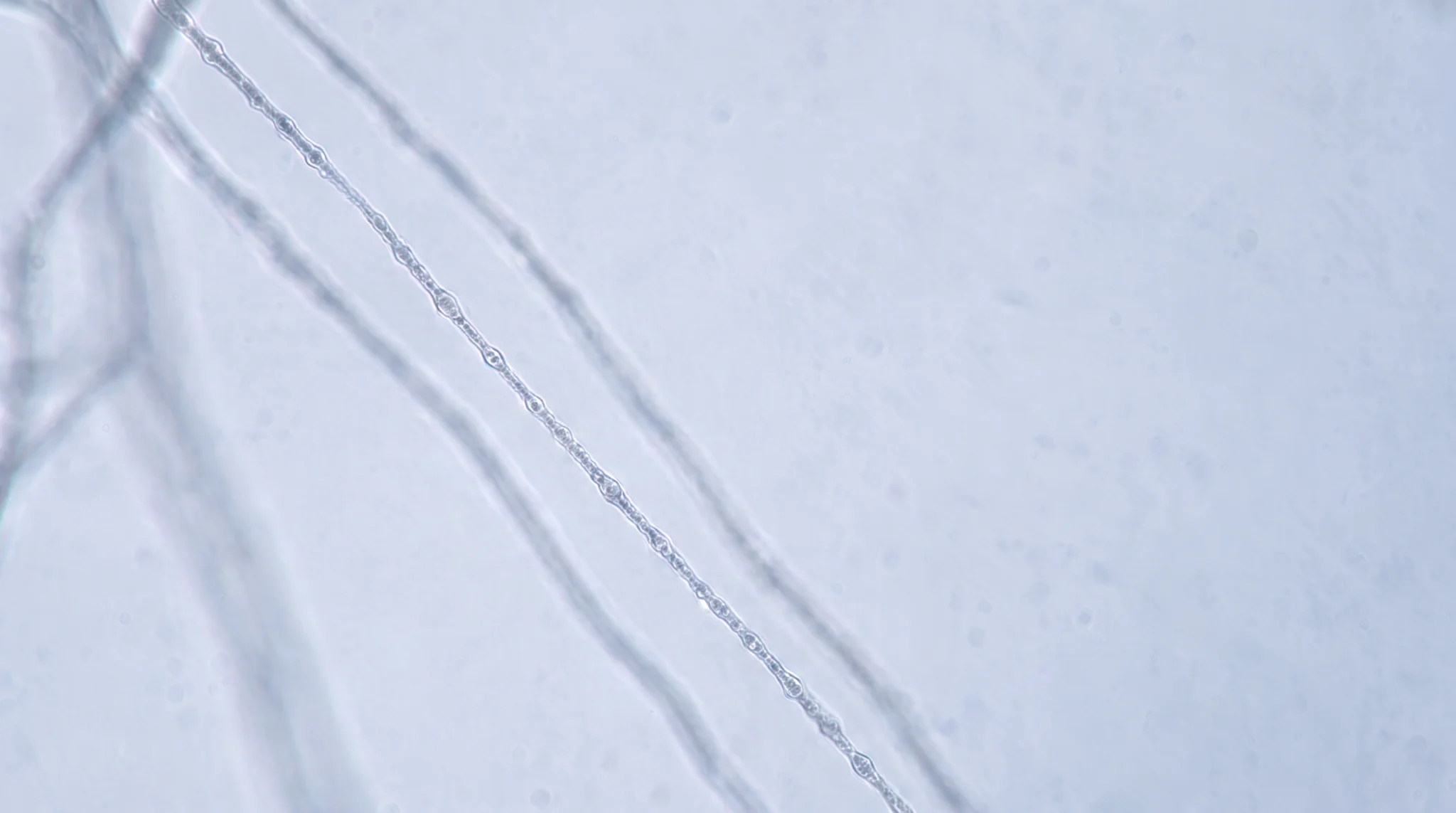 Cultured neurons and their branching neurites under a light microscope